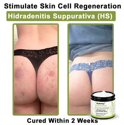 ✅Made in the USA: Rolimey® Magnesium herbal skin repair cream