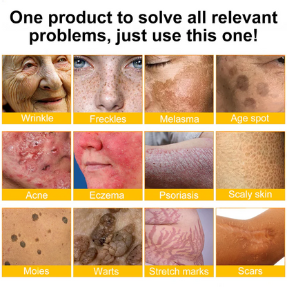 🧑‍⚕️Rolimey® Bee venom Pro Comprehensive Cream —Tightening for Skin Types 🔥
