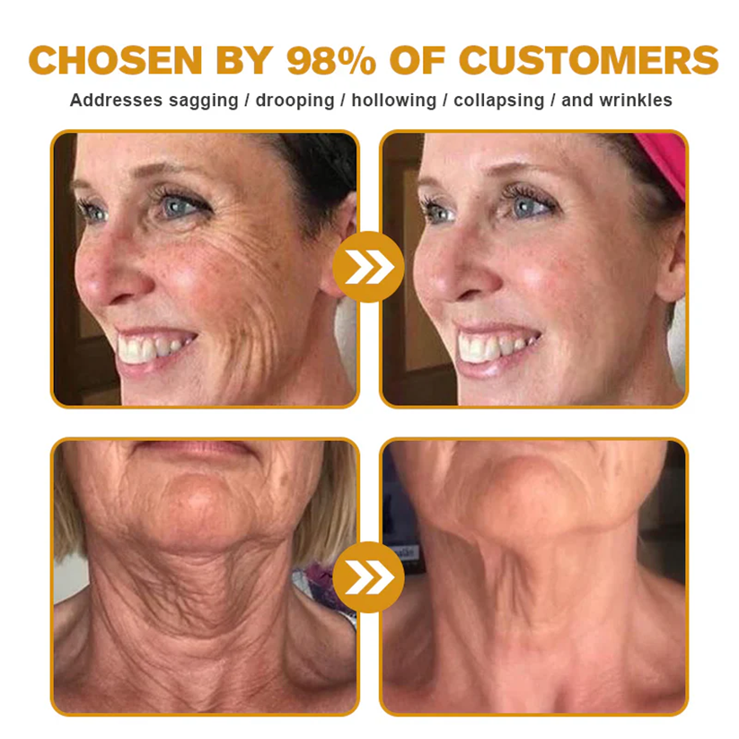 🧑‍⚕️Rolimey® Bee venom Pro Comprehensive Cream —Tightening for Skin Types 🔥