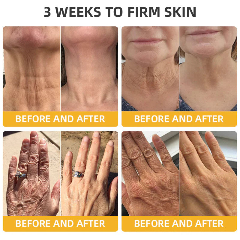 👨‍⚕️Official Brand Store | Rolimey® Bee Venom Retinol Skin Salve Ointment