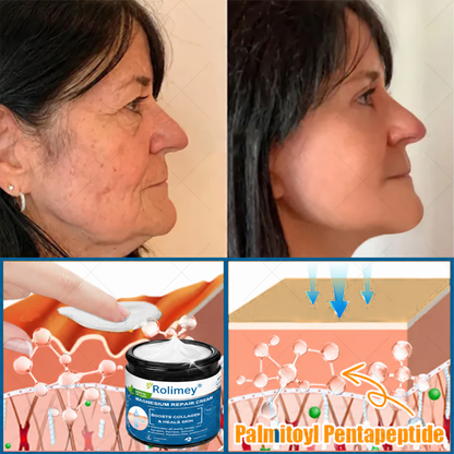 💯Official Store: Rolimey® Magnesium Skin Repair Cream (Smooths Wrinkles, Improves Skin Firmness, Tightens Skin)