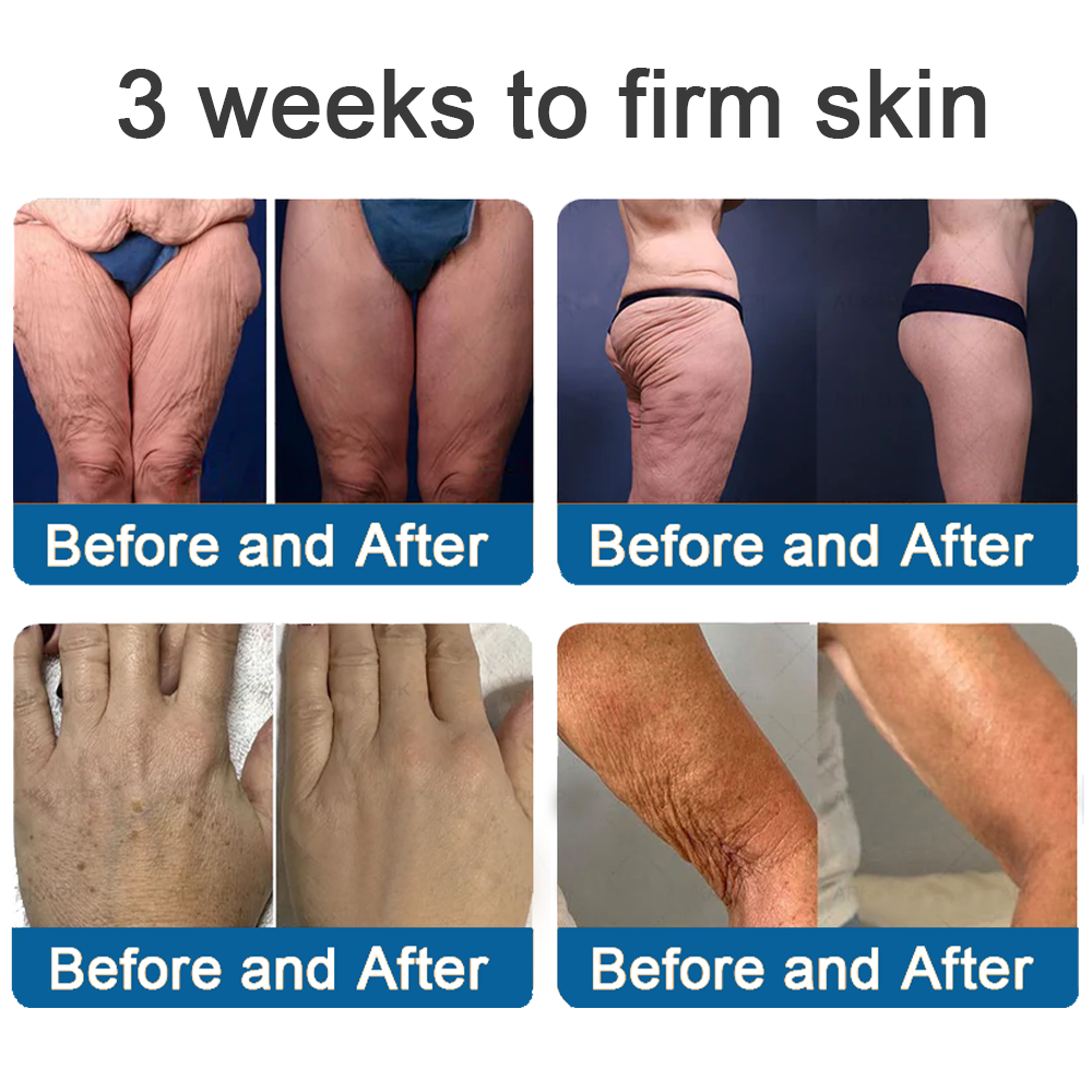💯Official Store: Rolimey® Magnesium Skin Repair Cream (Smooths Wrinkles, Improves Skin Firmness, Tightens Skin)