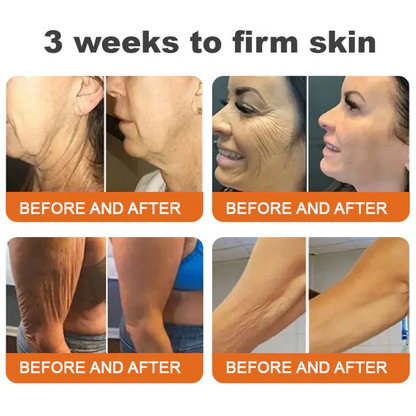 🧑‍⚕️Rolimey® Bee venom Pro Comprehensive Cream —Tightening for Skin Types 🔥