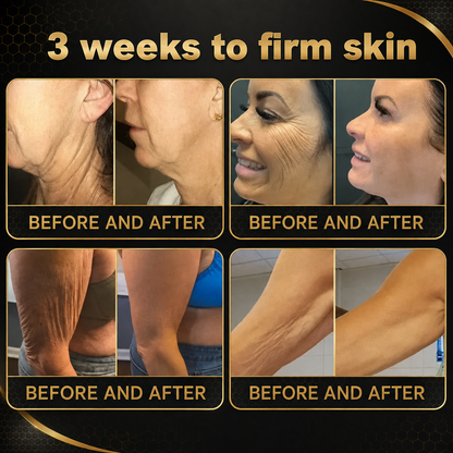 🐝Official Brand Black & Gold Upgraded Edition丨Rolimey® Bee venom Pro Comprehensive Cream —Tightening for Skin Types