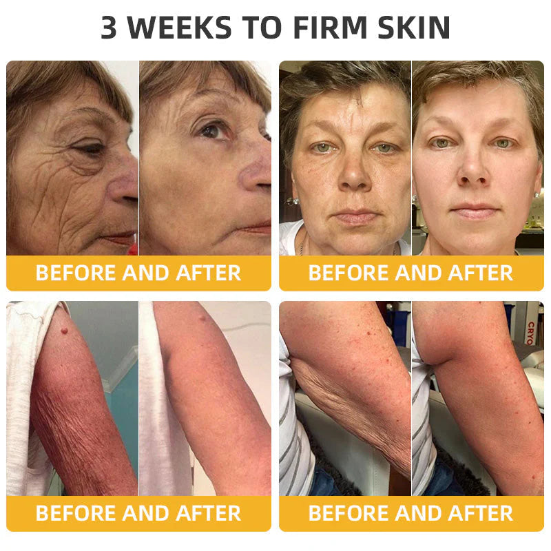 👨‍⚕️Official Brand Store | Rolimey® Bee Venom Retinol Skin Salve Ointment